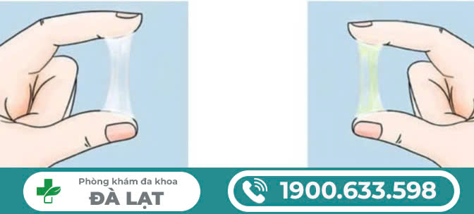 Hình ảnh minh họa